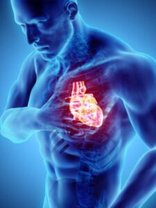7 Heart Attack Symptoms